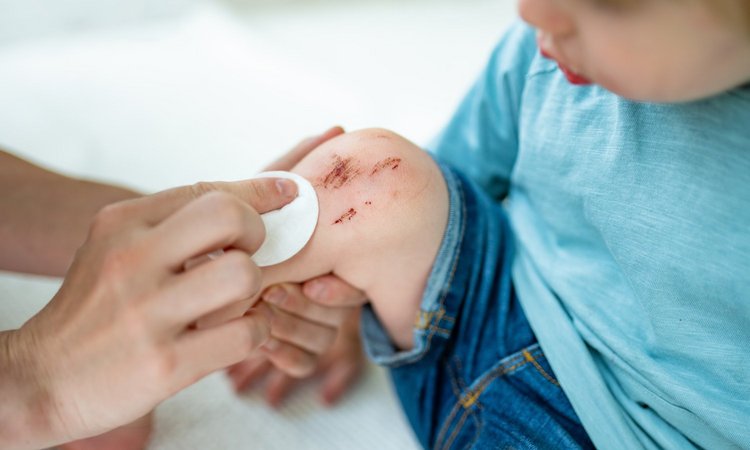 Kind mit aufgeschürftem Knie wird ärztlich versorgt