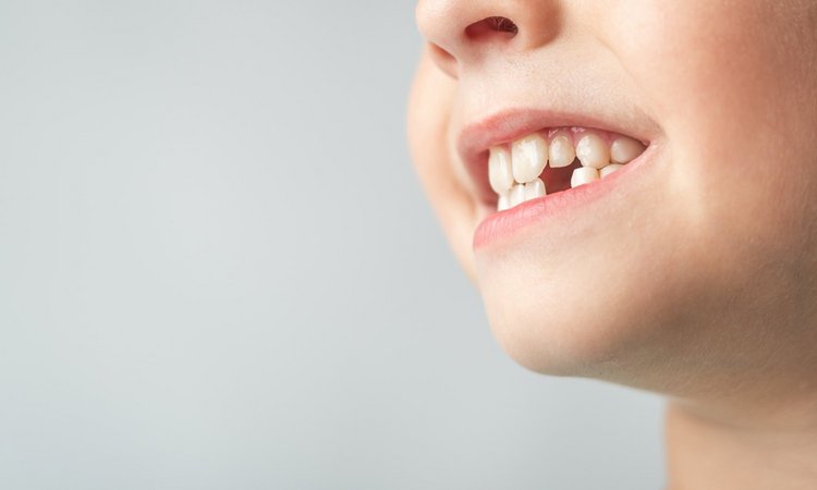 Nahaufnahme von Kind mit Zahnlücke